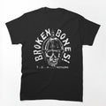 Broken Bones Shirt